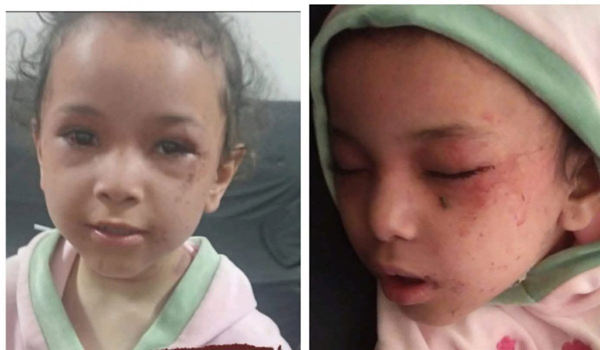  حكاية الطفلة بسملة التي عادت من الموت على يد جارتها بالمنيا
