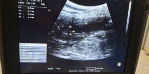 مستشفى الطب البيطري بجامعة قنا تستقبل حالة نادرة لكلبة جيرمان شيبرد تعاني من نزيف بالبول وخمول مزمن