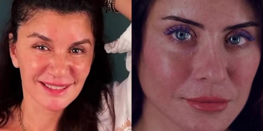 حصاد 2025.. رحلة الفنانات مع الإجراءات التجميلية بين الجرأة والمخاطر