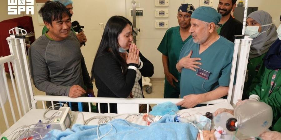 نجاح عملية فصل التوأم
الملتصق الفلبيني (أوليفيا وجيانا) بعد 6 ساعات