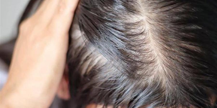 ماء البصل والكركدية لشعر طويل وكثيف وأكثر قوة