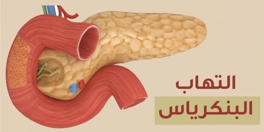 أعراض التهاب البنكرياس، استشاري باطنة يوضح ويحذر من إهمالها - النيل نيوز